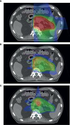 The Emerging Potential of Multi-Ion Radiotherapy